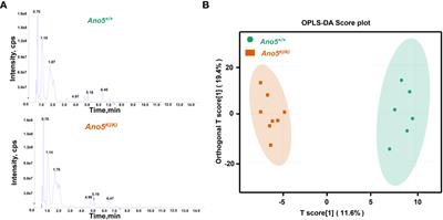 Integration of metabolomics and transcriptomics provides insights into enhanced osteogenesis in Ano5Cys360Tyr knock-in mouse model